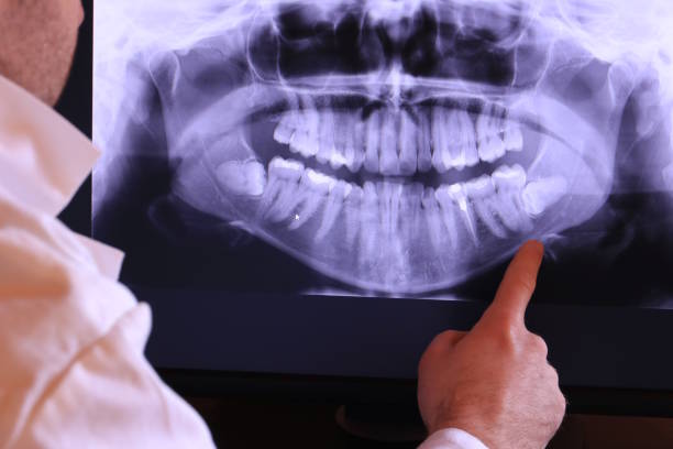 Best Pediatric Emergency Dentist in North Browning, MT
